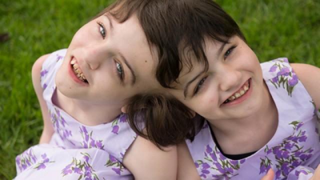 Inseparable: A Year in the Life of Tatiana and Krista Hogan, BC's Craniopagus Twins