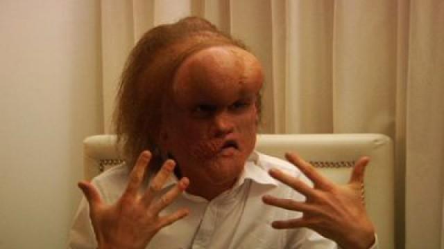 Elephant Man