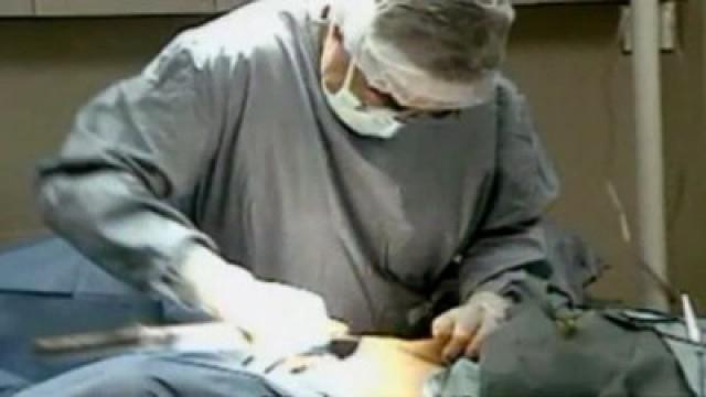 Chopped Off: The Man Who Lost His Penis