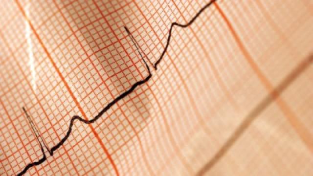 Willem Einthoven und das EKG