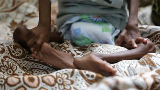 Starving Yemen