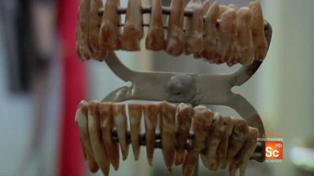 Teeth on a Stick