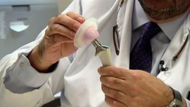 Informe Implantes: desprotegidos hasta los huesos