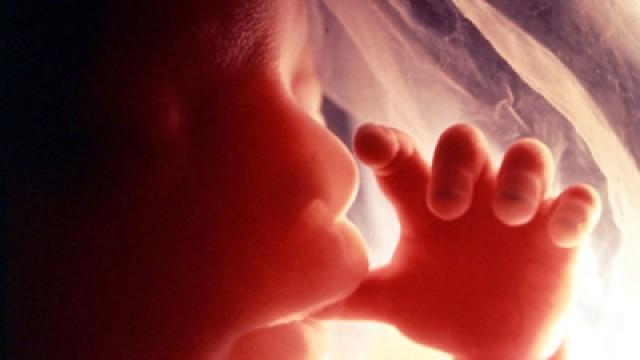 Pränataldiagnostik - der große Umbruch