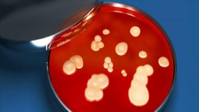 Wenn Antibiotika nicht mehr helfen - Die Angst vor den Killerkeimen