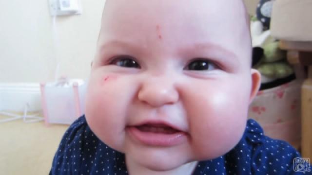 WHAT HAPPENED TO YOUR FACE?!