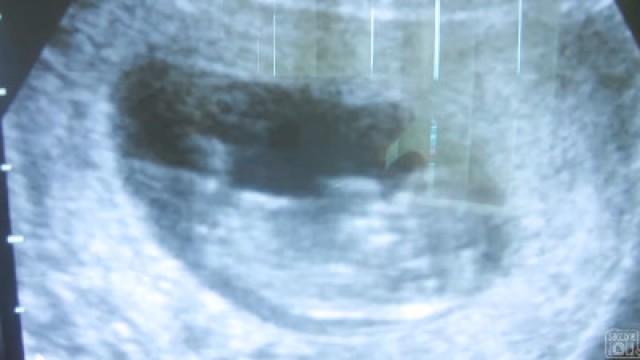 MEET OUR SECOND BABY!