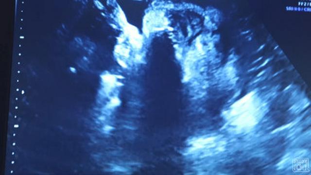 GETTING A BABY UPDATE!