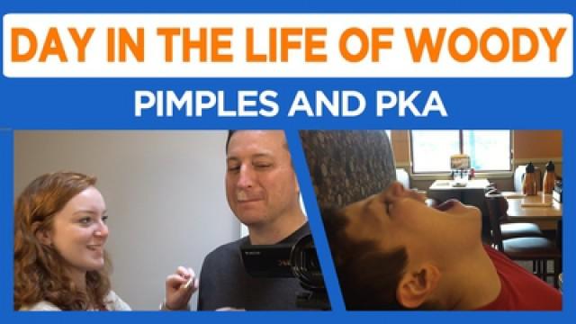 I HATE PIMPLES!!!