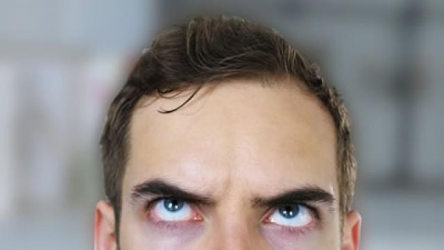 FIX MY FOREHEAD (YIAY #333)