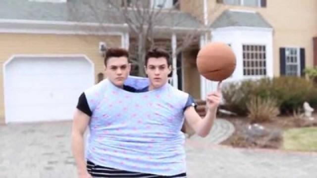 LIFE AS CONJOINED TWINS
