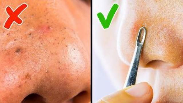 20 Astuces pour ta peau que tu aurais aimé connaître plus tôt