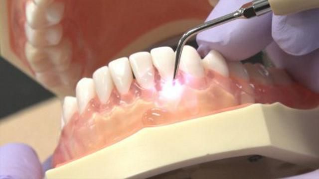 Gums, Germs and Healing