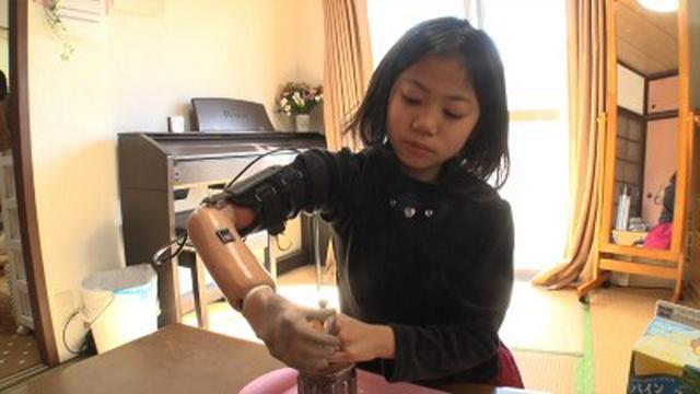 Robotic Hand for the Future