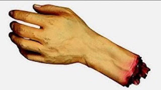 13 SEVERED HANDS! (2)