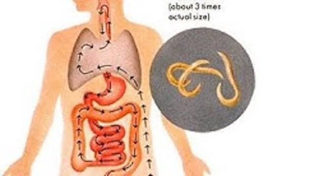 Top 10 Weirdest Diseases