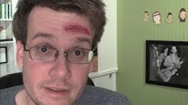 CONCUSSED Question Friday