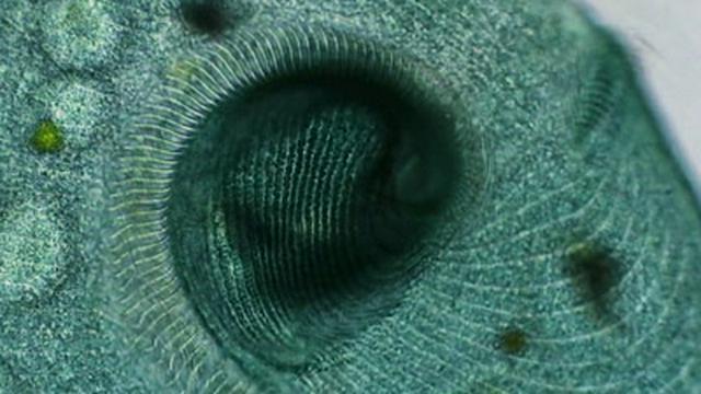 Stentors: Single-Celled Giants