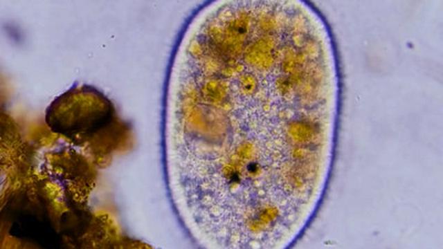 Mysterious Jiggly Crystals and Other Intracellular Structures
