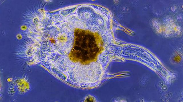 Rotifers: Charmingly Bizarre & Often Ignored