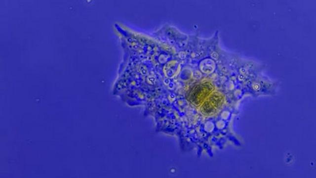 Amoebas: Occasional Brain-Eaters