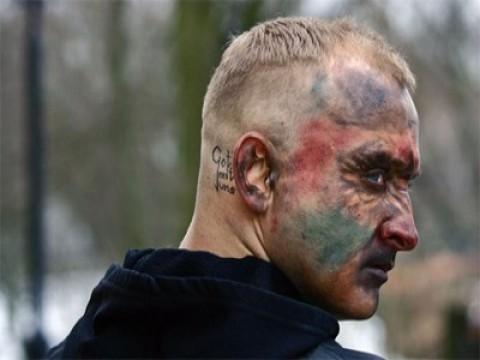 Dług i atak