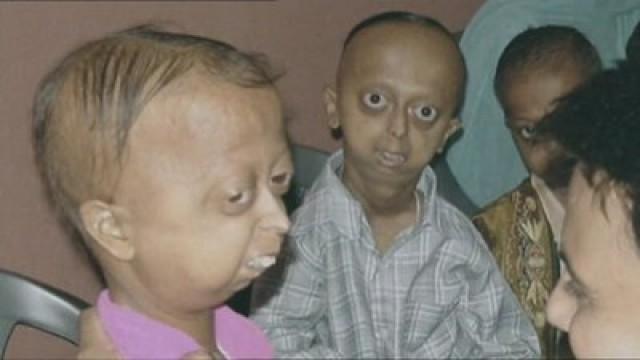 The 80-Year-Old Children