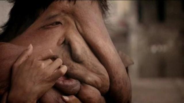 I Am the Elephant Man