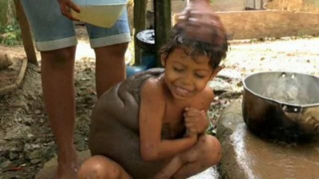 Turtle Boy