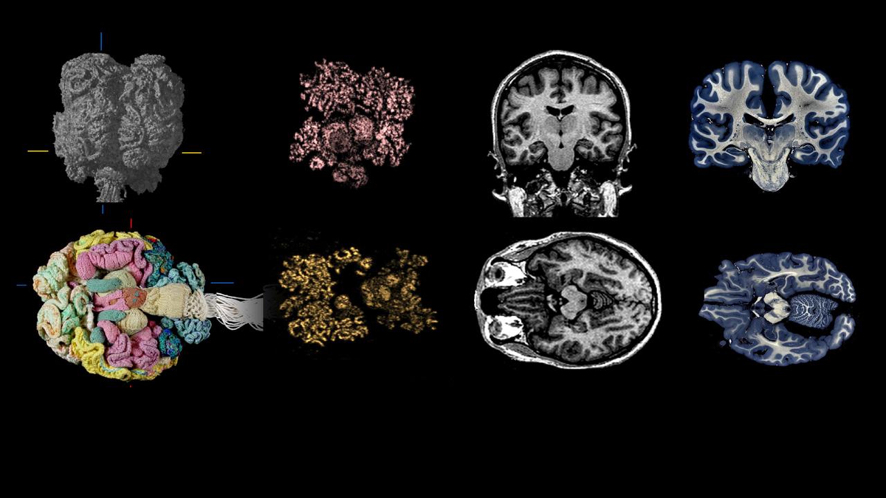 Brain Story
