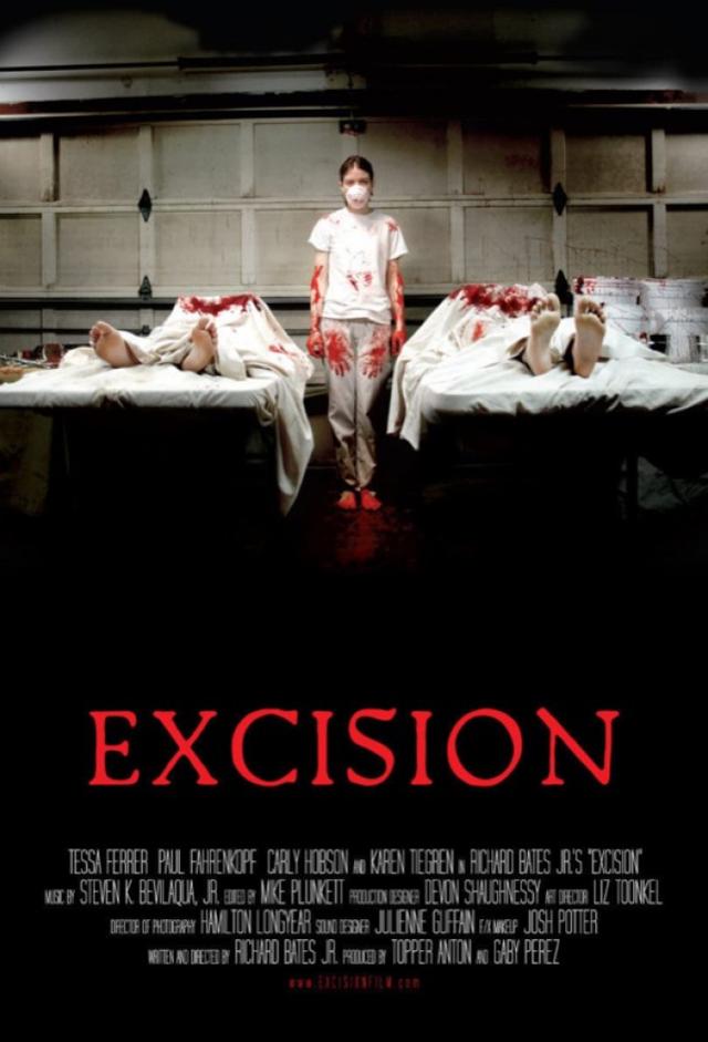 Excision