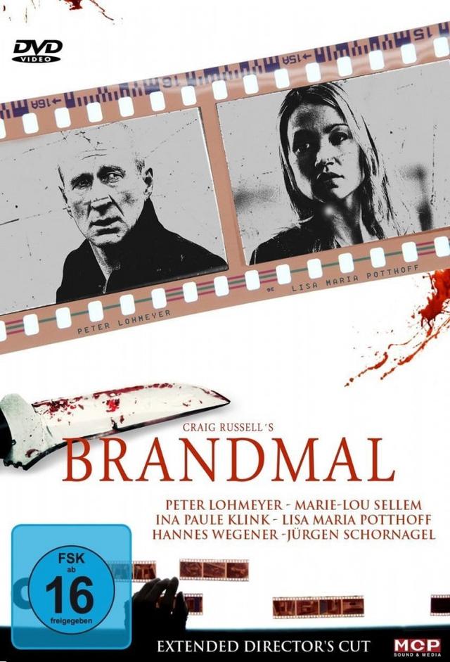 Brandmal