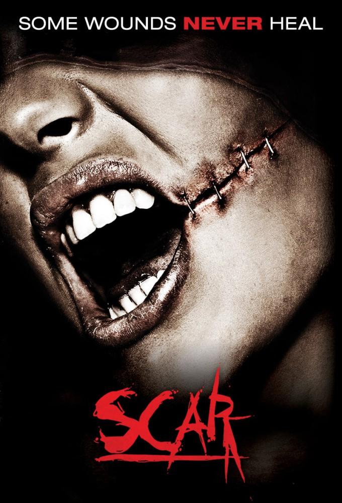 Scar