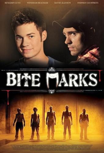 Bite Marks