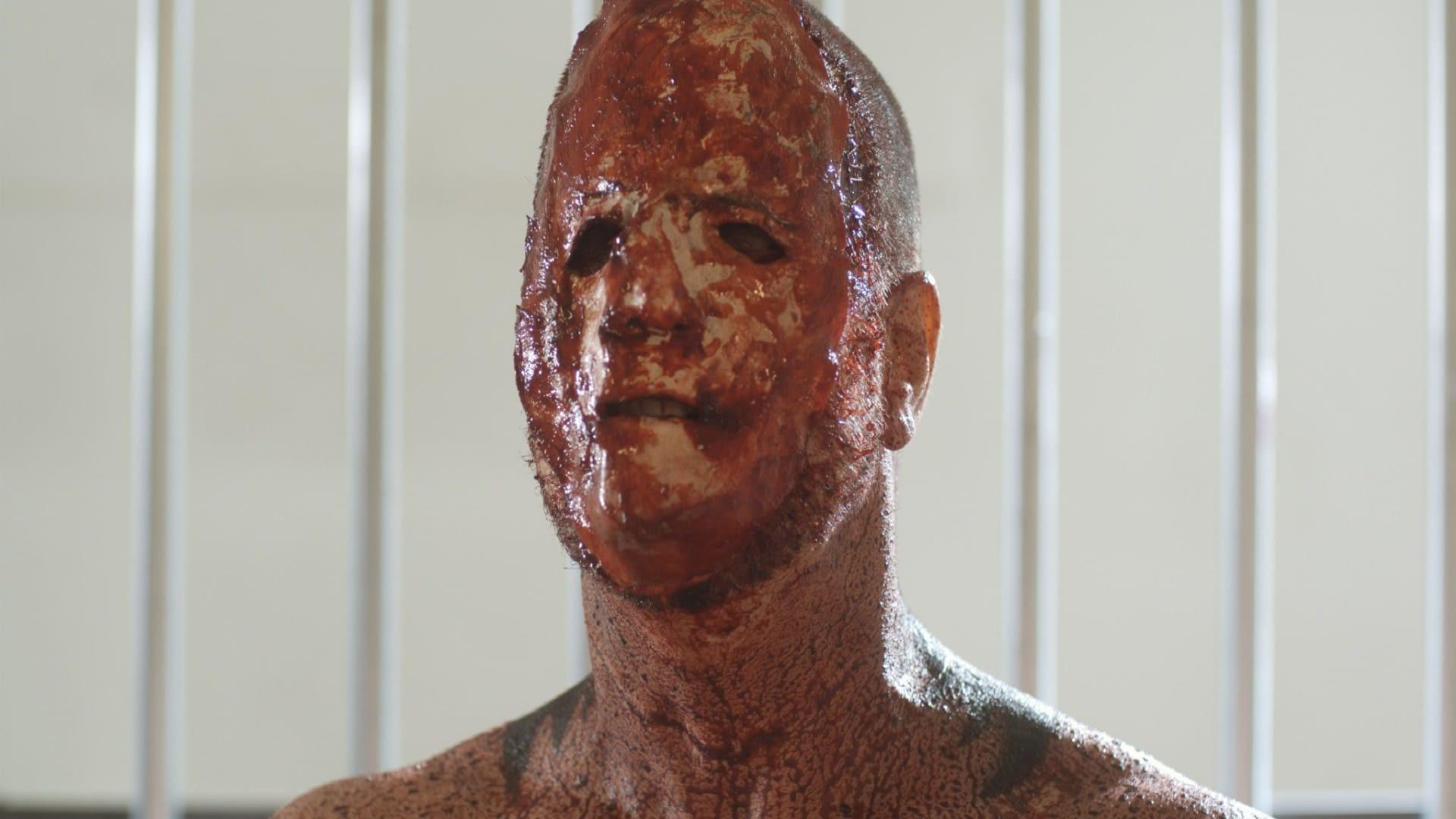 The Frankenstein Syndrome