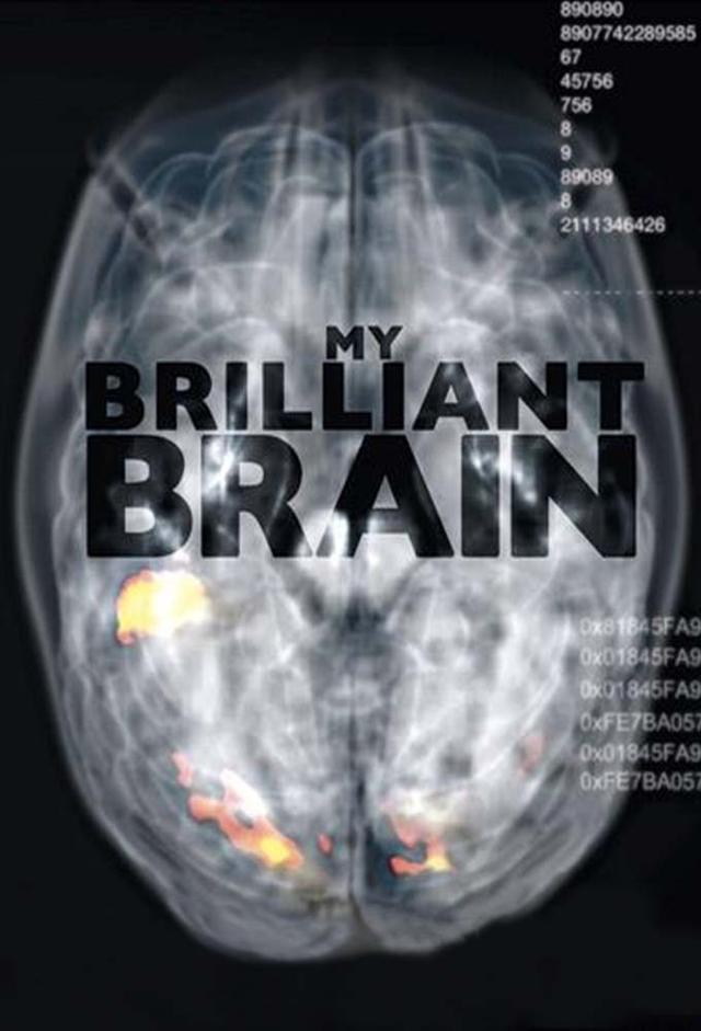 My Brilliant Brain