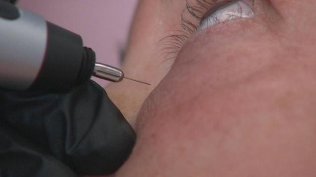 Non-Invasive Anti-Aging Treatment