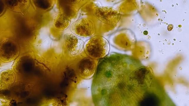 What Are These Vorticella up To?