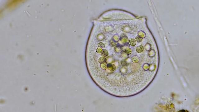 Peritrich Ciliates: Masters of Long-Range Snacking