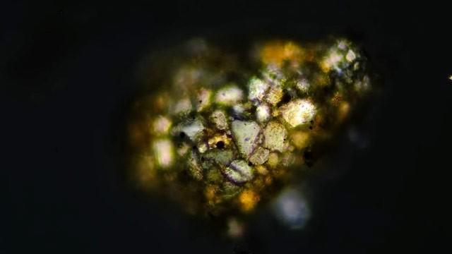 Testate Amoebas: Blobby, Modest Shell Dwellers