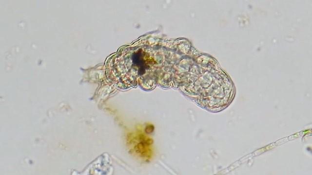 How Do Microorganisms Poop Without a Butthole?