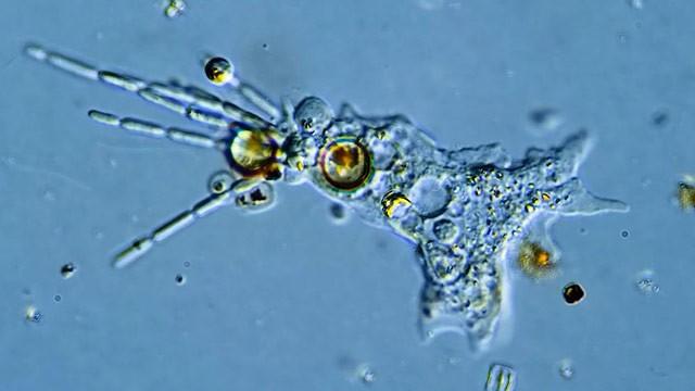 The Case of the Mistaken Amoeba