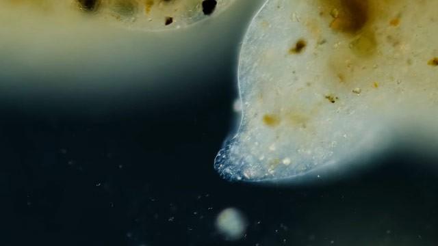 Pelomyxa: The Microbe That's Big Enough to Pet
