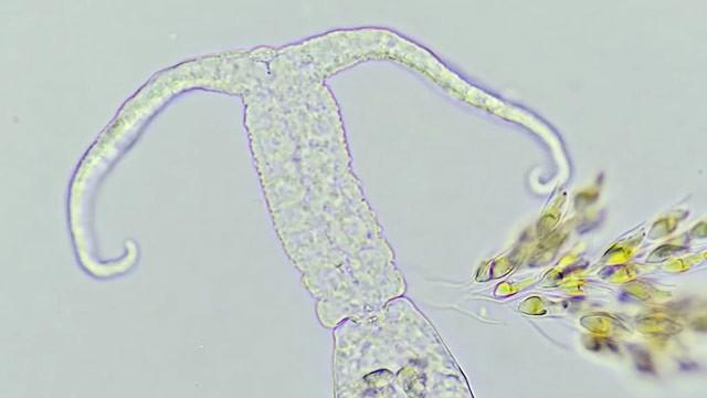 Are Microbes Good or Bad for Humans?