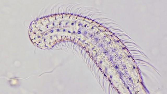 Gastrotrichs: Four Day Old Grandmothers