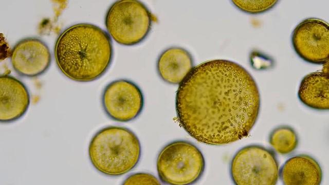 What If All the Microbes Disappeared?