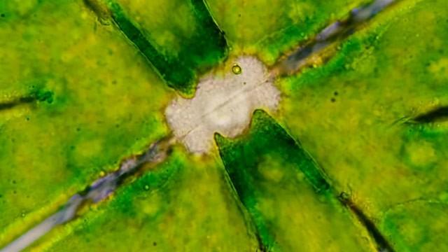 Desmids: The Symmetrical Algae That's Full of Crystals