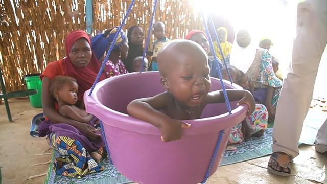 800 Millions are Starving - ٨٠٠ مليون يعاني الجوع