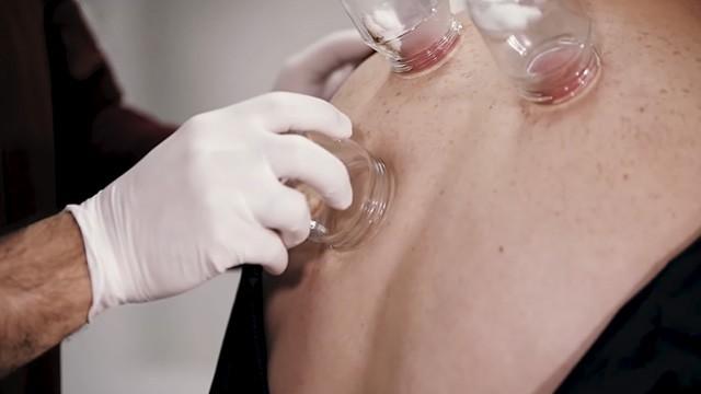 Blood Donation and Cupping - تبرع الدم والحجامة