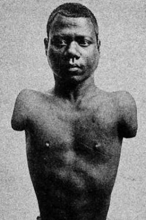 Picture of Prince Randian